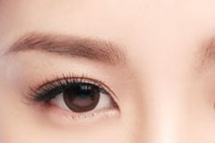 做雙眼皮整形醫(yī)院哪家好，幾天能恢復自然